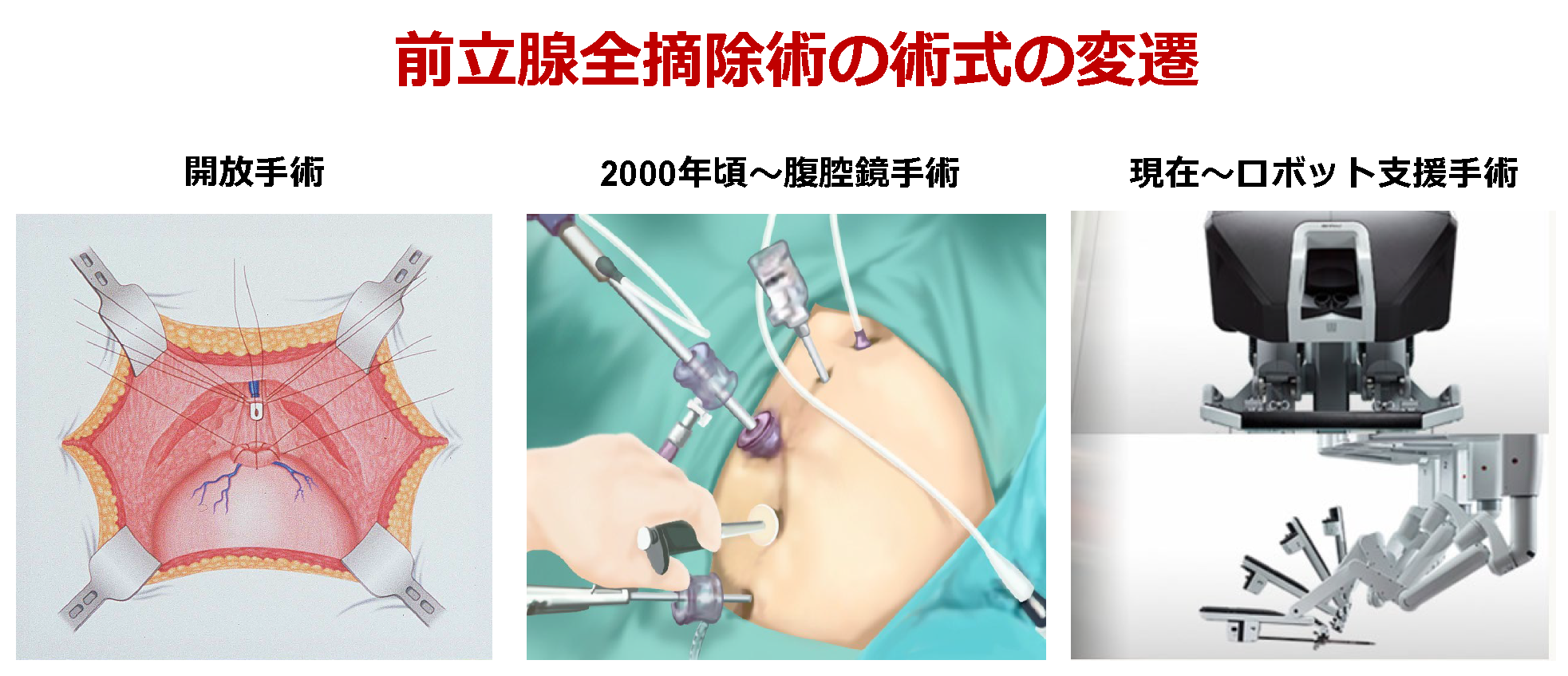 ロボット支援手術（ダビンチ）／藤枝市立総合病院
