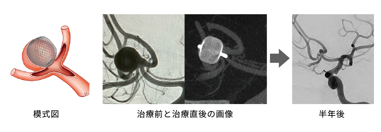 カゴ型WEBデバイスの一例