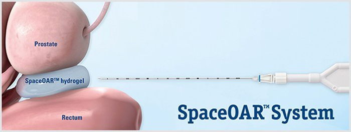 SpaceOARTMSystemバナー