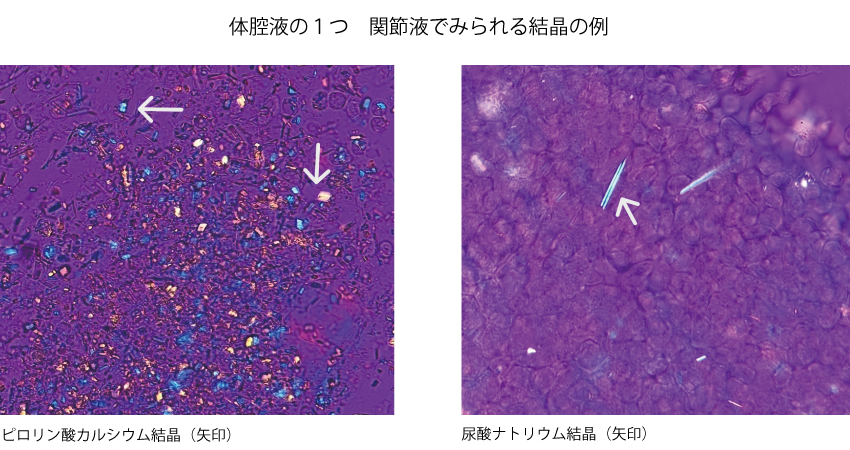 体腔液の1つ