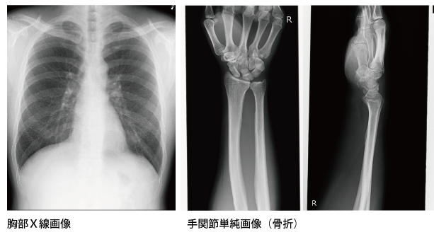 胸部X線画像と手関節単純画像