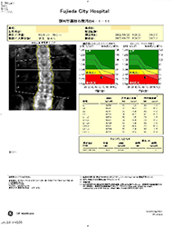 骨密度測定のグラフ
