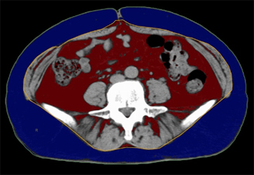 内臓脂肪の様子