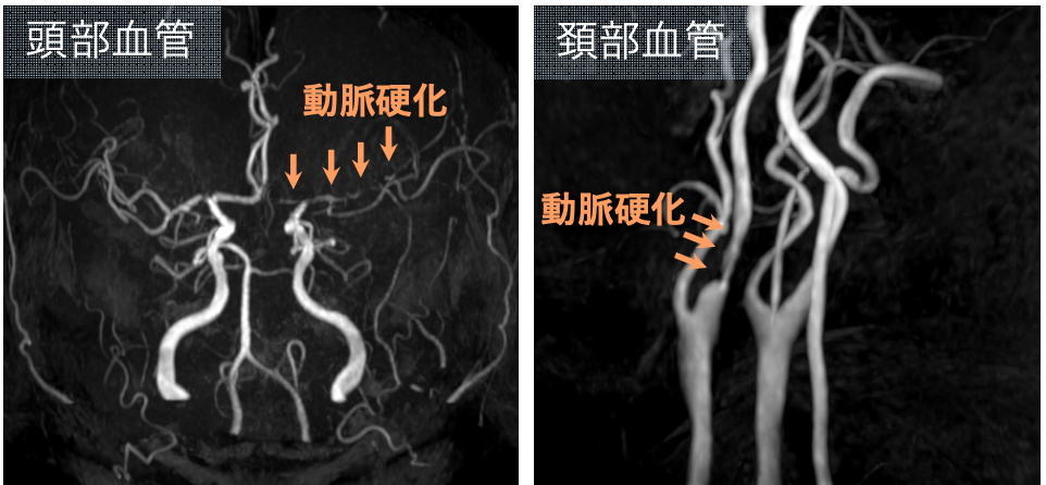 心臓検査の結果