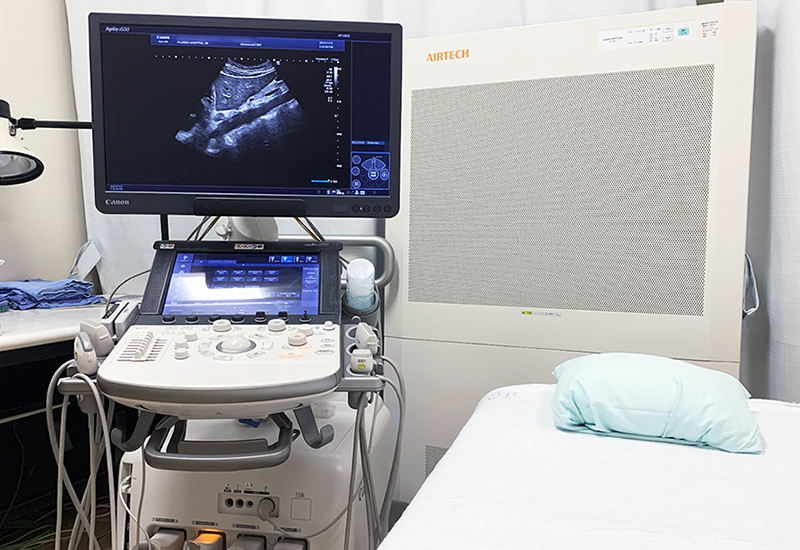 乳腺超音波検査（エコー）